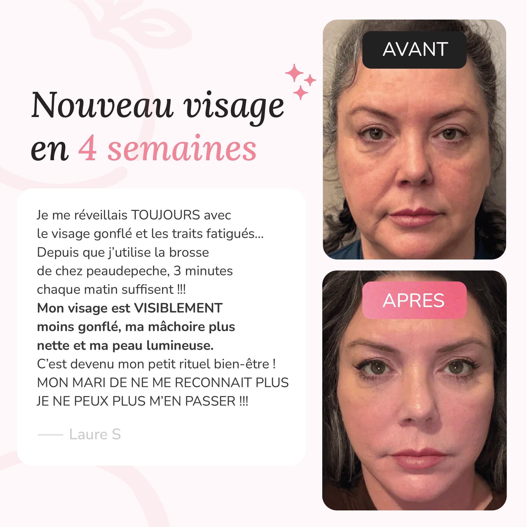 Brosse de drainage lymphatique du visage - Peaudepeche™